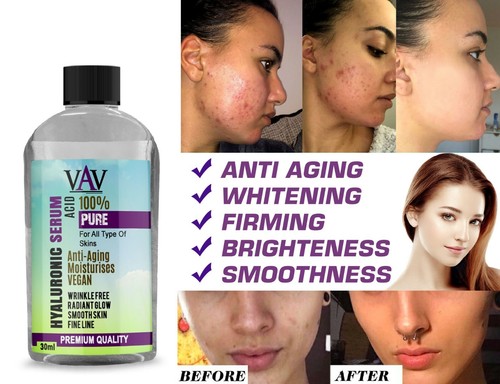 Organic 100 hyaluronic - hyaluronic, acid